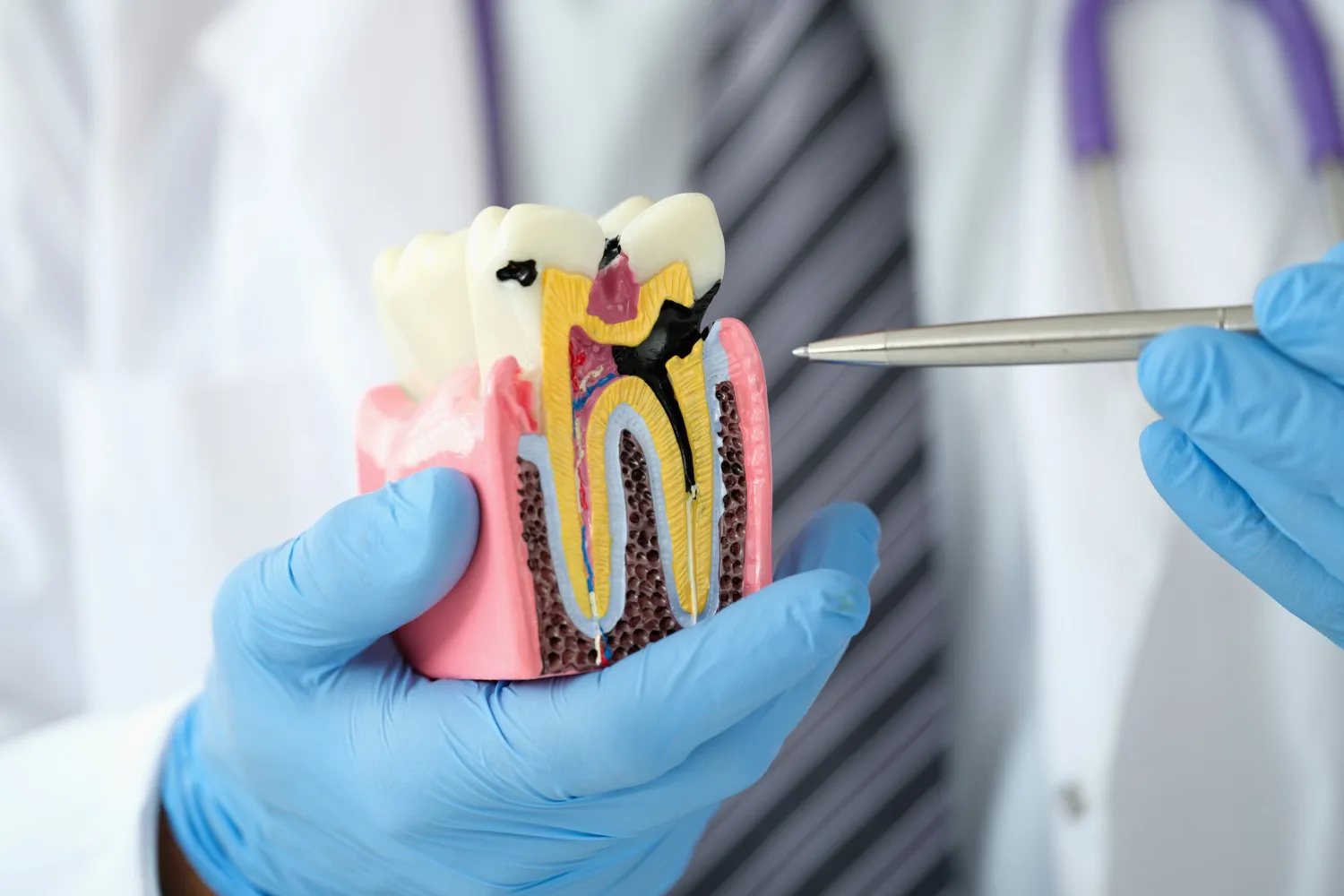 Regeneración ósea en CDMX: La solución avanzada para recuperar la salud dental